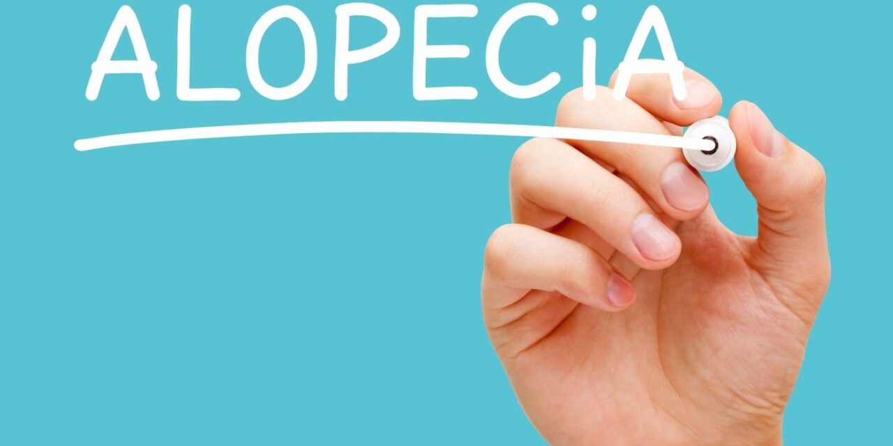 Alopecia Areata